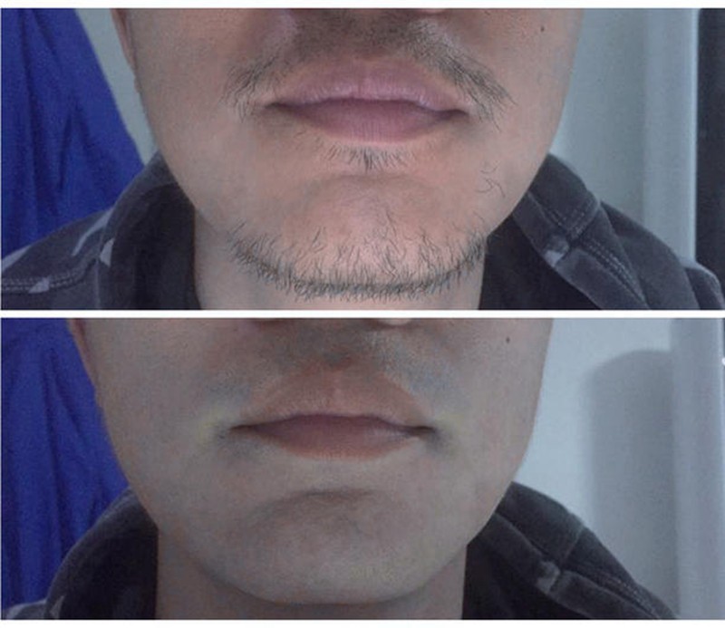 1524619992994851.jpg 1524619992994851.jpg